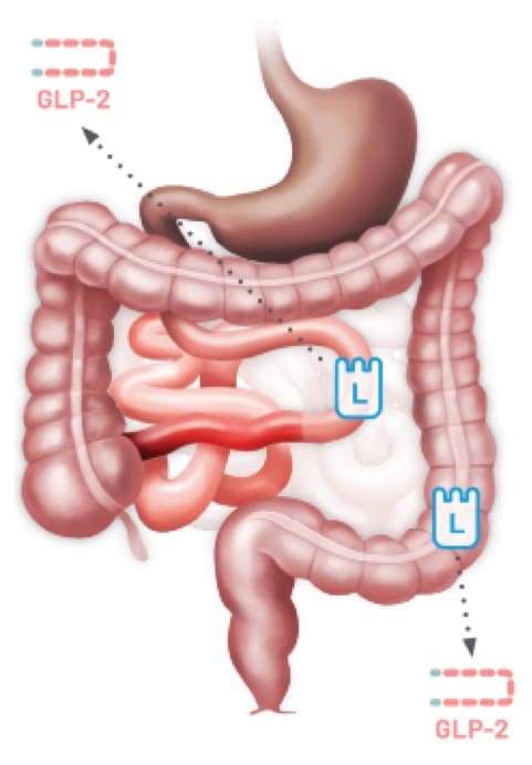 Illustration showing the GLP-2 pathway in a type 3 jejunoileal anastomosis. The image highlights GLP-2 movement through the small intestine and colon.